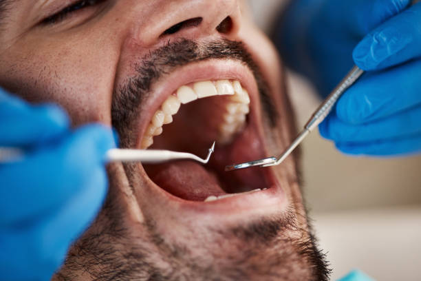 Best Urgent Care for Lost Fillings or Crowns in Jefferson, NC