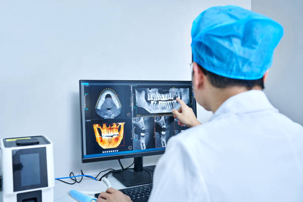 Best Emergency Wisdom Teeth Removal in Jefferson, NC