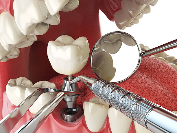 Best Pediatric Emergency Dentist in Jefferson, NC